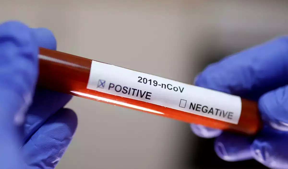 कोरोनाकै कारण बाजुराकी २ बर्षिया बालिकाको मृत्यु भएको पुष्टि, आमा पनि संक्रमित