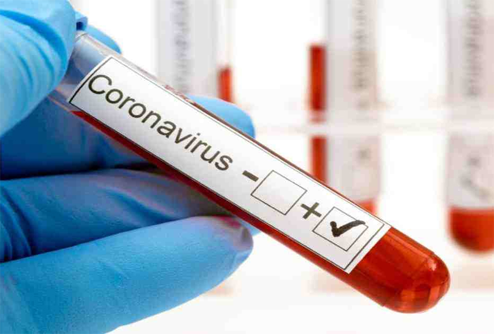 कर्णालीमा फेरी थपियो ३२ जना संक्रमित