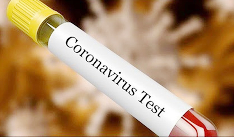 पीसीआर परीक्षणको शुल्क घट्यो