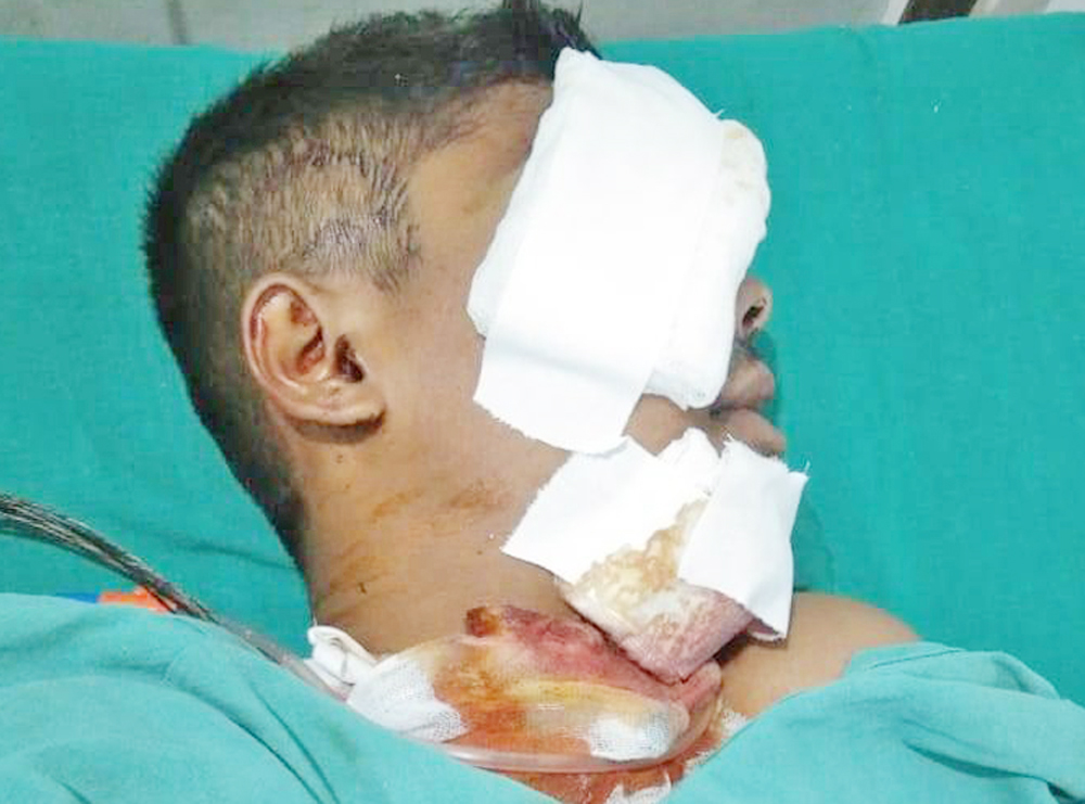 आफैंले बोकेको राइफल पड्किदाँ सेनाका जवान गम्भीर घाइते