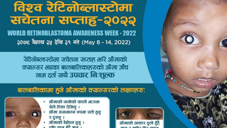 समयमै उपचार गरे निको हुन्छ बालबालिकाको आँखामा हुने क्यान्सर