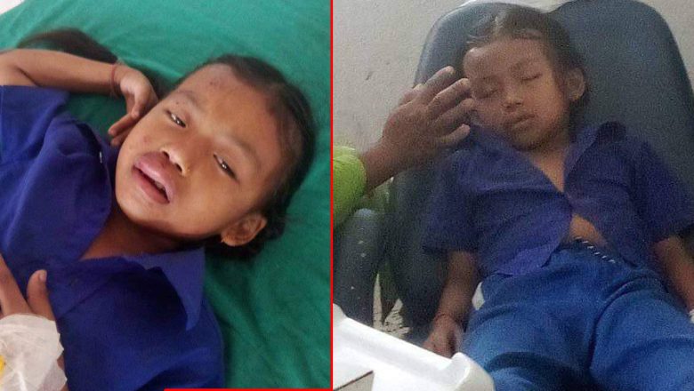 गाईघाटमा मोटरसाईकलले ठक्कर दिँदा स्कुले बच्चा घाईते
